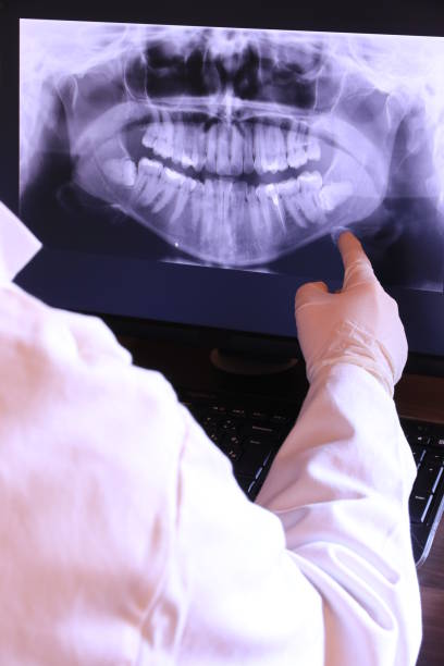 Best Emergency TMJ Treatment in Belle Rose, LA